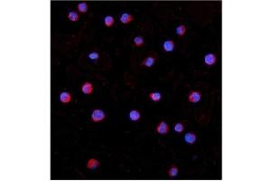 IF analysis of IRAK1 using anti- IRAK1 antibody (ABIN7603128).