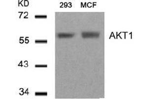 Image no. 3 for anti-V-Akt Murine Thymoma Viral Oncogene Homolog 1 (AKT1) (Thr450) antibody (ABIN319375) (AKT1 Antikörper  (Thr450))