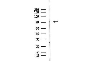 Western blot analysis of lysates from  cells(starvation,24h treatment), using BRF1 Antibody at 1/1000 dilution.