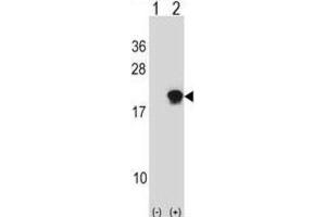 Western Blotting (WB) image for anti-Small Ubiquitin Related Modifier 4 (SUMO4) antibody (ABIN2996865) (SUMO4 Antikörper)