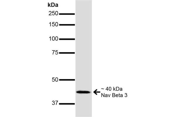 SCN3B anticorps  (AA 1-215)