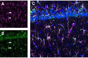 Expression of GFAP and TSH Receptor in rat hippocampus CA1 region. (Glial Fibrillary Acidic Protein (GFAP) Peptid)