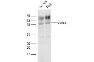 Lane 1: Mouse spleen lysates, Lane 2: Raji lysates, probed with Anti-WASP Polyclonal Antibody at 1:5000 90min in 37˚C. (WASP Antikörper  (AA 101-200))