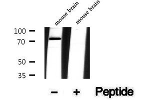 Western blot analysis of extracts of mouse brain tissue, using Phospho-Tau (Ser416) Antibody .
