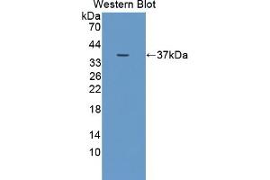 Detection of recombinant DUOX2 using Polyclonal Antibody to Dual Oxidase 2 (DUOX2)