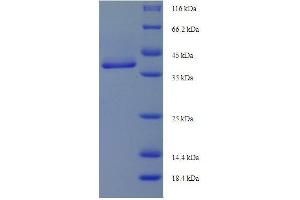 SDS-PAGE (SDS) image for Annexin A5 (ANXA5) (AA 1-323) protein (His tag) (ABIN7479334)