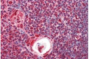 Anti-HnRNP K antibody IHC staining of human thymus. (HNRNPK Antikörper  (AA 1-50))