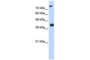 Image no. 1 for anti-ISL LIM Homeobox 2 (ISL2) (N-Term) antibody (ABIN6742917) (ISL2 Antikörper  (N-Term))