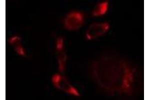 ABIN6275514 staining A549 cells by IF/ICC. (SCFD1 Antikörper  (C-Term))