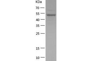 Western Blotting (WB) image for Nuclear Factor of kappa Light Polypeptide Gene Enhancer in B-Cells 1 (NFKB1) (AA 2-434) protein (His tag) (ABIN7124204) (NFKB1 Protein (AA 2-434) (His tag))