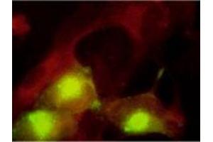 Immunofluorescence (IF) image for anti-Pp28 Tegument Protein (CMV Pp28) antibody (ABIN265539) (Pp28 Tegument Protein (CMV Pp28) Antikörper)