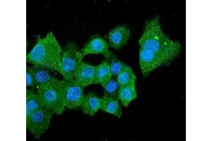 IF analysis of ALDH2 using anti-ALDH2 antibody (ABIN7603107).
