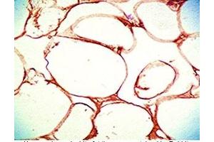 Immunohistochemistry (IHC) image for anti-serpin Peptidase Inhibitor, Clade A (Alpha-1 Antiproteinase, Antitrypsin), Member 12 (SERPINA12) (AA 63-104) antibody (ABIN2872791)