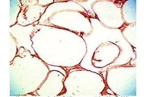 Human visceral white fat tissue was stained by Rabbit Anti-Vaspin (63-104) (Human) Serum (SERPINA12 Antikörper  (AA 63-104))