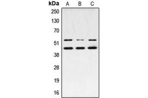 Western blot analysis of JNK1/2/3 (pT183) expression in MCF7 PMA-treated (A), NIH3T3 UV-treated (B), PC12 PMA-treated (C) whole cell lysates. (JNK Antikörper  (pSer183))