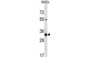 Western Blotting (WB) image for anti-Olfactory Receptor, Family 2, Subfamily W, Member 5 (OR2W5) antibody (ABIN2998137) (OR2W5 Antikörper)