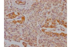 IHC image of ABIN7127485 diluted at 1:100 and staining in paraffin-embedded human pancreatic tissue performed on a Leica BondTM system. (Rekombinanter FBP1 Antikörper)