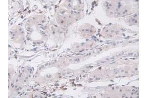 Immunohistochemistry (IHC) image for anti-Lymphocyte Cytosolic Protein 1 (LCP1) (AA 5-233) antibody (ABIN7435001)