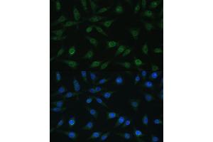 Immunofluorescence analysis of L929 cells using NUP98 antibody (ABIN1681142, ABIN3015191, ABIN3015192, ABIN5663696 and ABIN6213876) at dilution of 1:100. (NUP98 Antikörper  (AA 621-920))