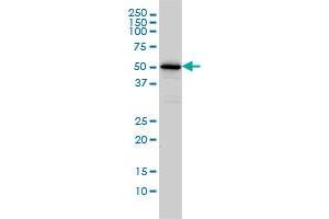 CAMKK1 monoclonal antibody (M01A), clone 1F6 Western Blot analysis of CAMKK1 expression in Jurkat . (CAMKK1 Antikörper  (AA 1-520))