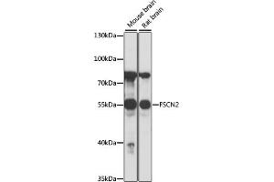 Western blot analysis of extracts of various cell lines, using FSCN2 antibody (ABIN7267143) at 1:1000 dilution. (Fascin 2 Antikörper  (AA 1-310))
