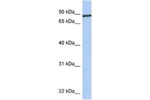 WB Suggested Anti-JPH1 Antibody Titration:  0.