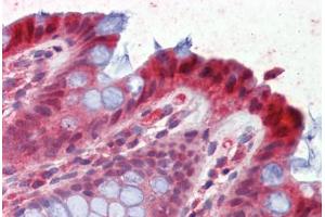 Human Colon (formalin-fixed, paraffin-embedded) stained with HPGD antibody ABIN462285 followed by biotinylated anti-goat IgG secondary antibody ABIN481715, alkaline phosphatase-streptavidin and chromogen. (HPGD Antikörper  (AA 255-266))