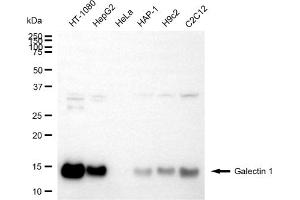 Western blotting analysis using galectin 1 antibody (ABIN7799241).