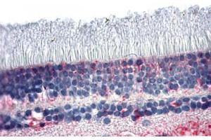 Anti-NR2E3 antibody  ABIN1049136 IHC staining of human retina. (NR2E3 Antikörper  (N-Term))