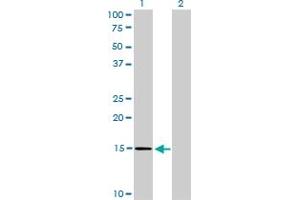 Western Blot analysis of NXT1 expression in transfected 293T cell line by NXT1 monoclonal antibody (M08), clone 4F11.
