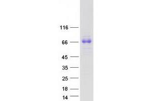 Western Blotting (WB) image for serine Peptidase Inhibitor, Kunitz Type 1 (SPINT1) (Transcript Variant 3) protein (Myc-DYKDDDDK Tag) (ABIN2732599)