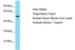 Image no. 1 for anti-Forkhead Box P3 (FOXP3) (AA 23-72) antibody (ABIN6750280) (FOXP3 Antikörper  (AA 23-72))