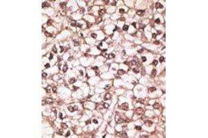 Image no. 2 for anti-ATP-Binding Cassette, Sub-Family B (MDR/TAP), Member 4 (ABCB4) (Center) antibody (ABIN358591)