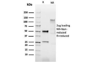 SDS-PAGE Analysis of Purified HPV16 Rabbit Recombinant Monoclonal Antibody (HPV16/2058R).