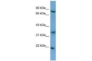 ABCD2 antibody used at 0. (CCL17 Antikörper  (N-Term))