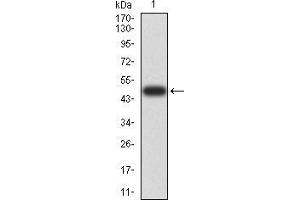 Western blot analysis using DHX58 mAb against human DHX58 (AA: 479-678) recombinant protein. (DHX58 Antikörper  (AA 479-678))