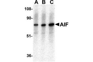 Western blot analysis of AIF in K562 with AP30031PU-N AIF antibody at (A) 0. (AIF Antikörper  (C-Term))