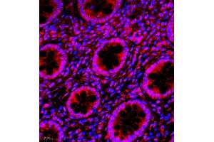 Immunofluorescence of paraffin embedded human colon using NAIF1 (ABIN7074867) at dilution of 1:650 (400x lens) (NAIF1 Antikörper)