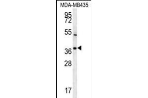 TNIP3 Antibody (N-term) (ABIN651787 and ABIN2840400) western blot analysis in MDA-M cell line lysates (15 μg/lane). (TNIP3 Antikörper  (N-Term))