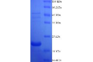 SDS-PAGE (SDS) image for Antigen Identified By Monoclonal Antibody Ki-67 (MKI67) (AA 3120-3256) protein (His tag) (ABIN5713646) (Ki-67 Protein (AA 3120-3256) (His tag))