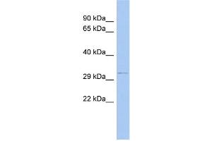 WB Suggested Anti-ODF4 Antibody Titration: 0. (ODF4 Antikörper  (N-Term))