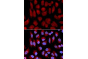Immunofluorescence analysis of U2OS cells using TAP2 antibody (ABIN5970782).