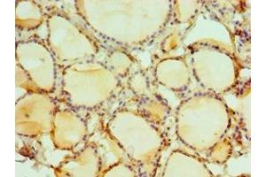 Immunohistochemistry of paraffin-embedded human thyroid tissue using ABIN7149566 at dilution of 1:100 (DIDO1 Antikörper  (AA 1-300))