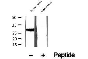 Western blot analysis of extracts of human testis tissue, using CRISP2 antibody. (CRISP2 Antikörper  (Internal Region))