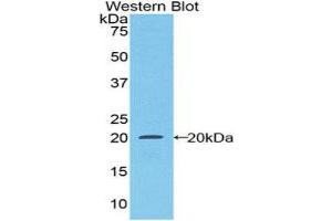 Western Blotting (WB) image for anti-Colony Stimulating Factor 1 Receptor (CSF1R) (AA 734-900) antibody (ABIN1174698) (CSF1R Antikörper  (AA 734-900))