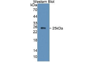 Figure. (XPO5 Antikörper  (AA 2-180))