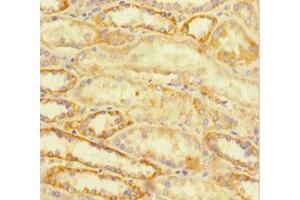 Immunohistochemistry of paraffin-embedded human kidney tissue using ABIN7172767 at dilution of 1:100 (ATRX Antikörper  (AA 2161-2443))