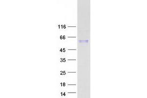 Western Blotting (WB) image for Transforming Growth Factor, beta 1 (TGFB1) protein (Myc-DYKDDDDK Tag) (ABIN2733505)