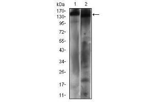 Western blot analysis using PTPRC mouse mAb against Hela (1) and A431 (2) cell lysate. (CD45 Antikörper  (AA 928-989))