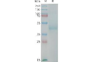 SDS-PAGE (SDS) image for LI Cadherin (AA 567-667) protein (mFc Tag) (ABIN7538360)